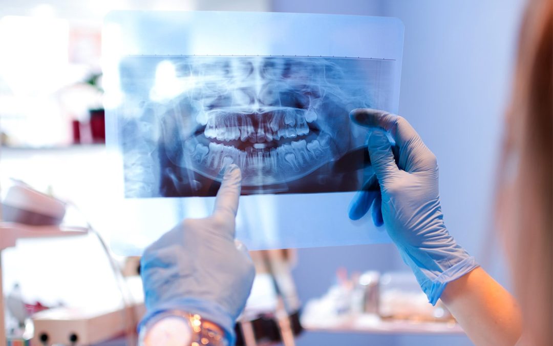 Les différentes anomalies dentaires